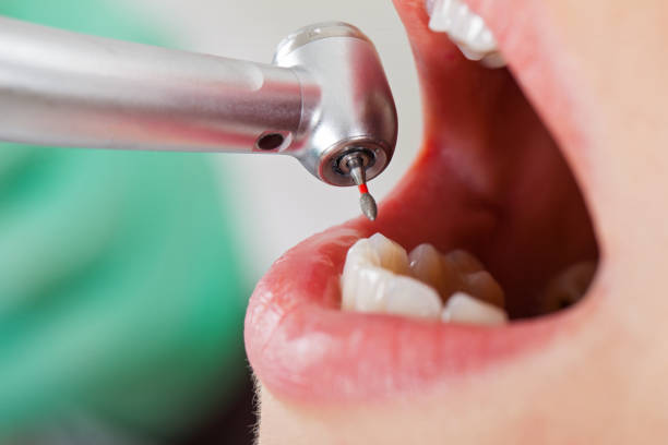 Best Dentist for Tooth Abscess  in Rexburg, ID